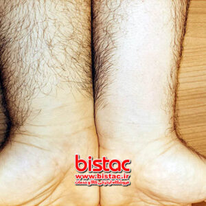 Crystal-Hair-Removal-bistac-ir03